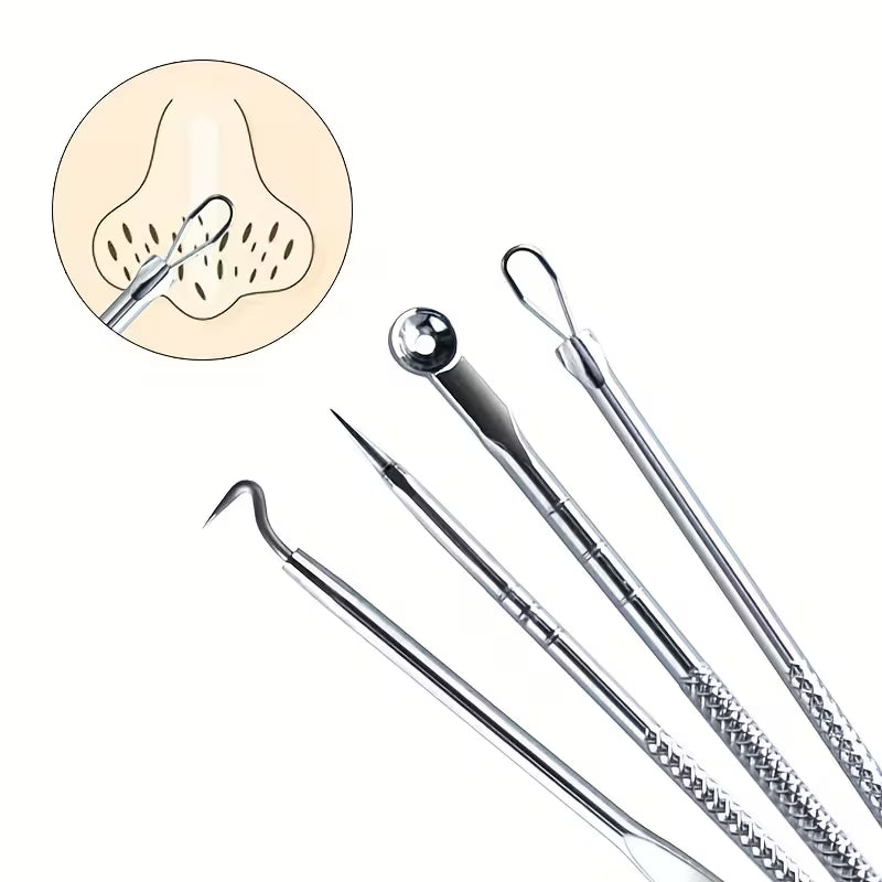 Professional Blackhead Remover Tool Set - 4pcs Stainless Steel Extractor Kit